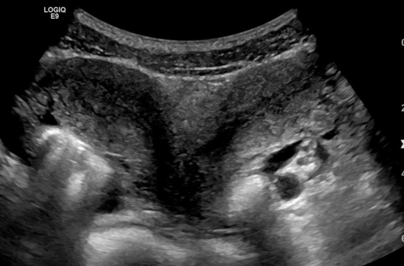 Mulher com dois úteros está grávida de dois bebês, um em cada órgão, em  caso raríssimo – Cabeça de Criança